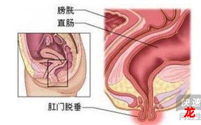 肛周脓肿完结网页版全集直接观看